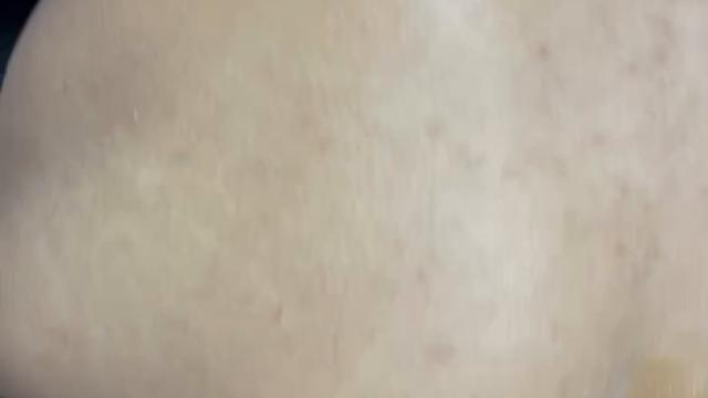 Com carinha de dor PARTE 2 