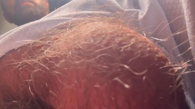 Vídeo 6 de 17