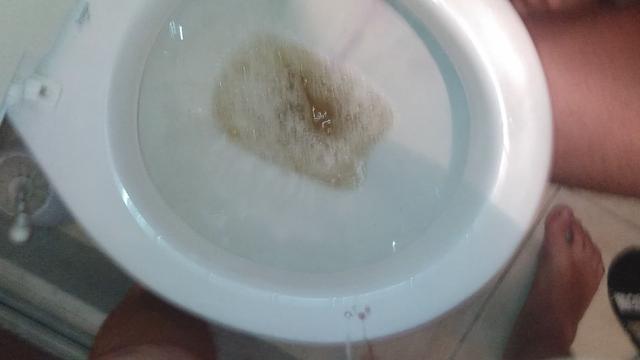 Bebendo mijão da privada 