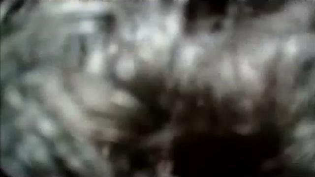 Dindin x dindinzinho 