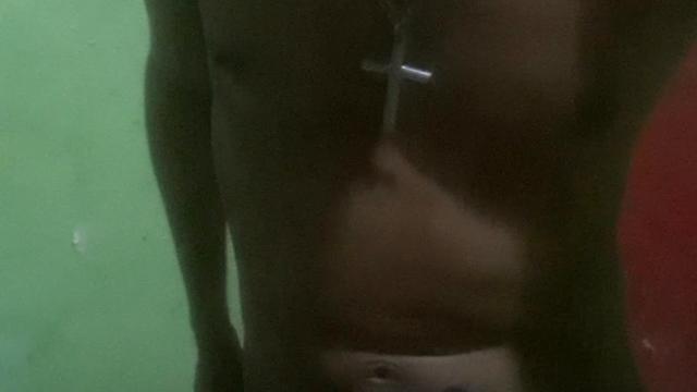 DINDIN X FRENTISTA CASADO