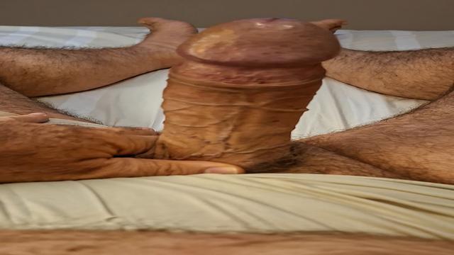ACORDEI COM A PICA TODA ESFOLADA DEPOIS UMA BELA TRE...