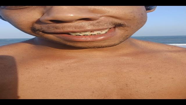 Na Praia pode??