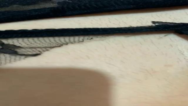 Deixei o podolatra botar um pouquinho no pelo