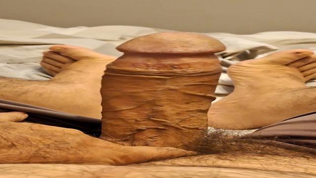 ACORDANDO DE BARRACA ARMADA DE PICAO TODO ESFOLADO 