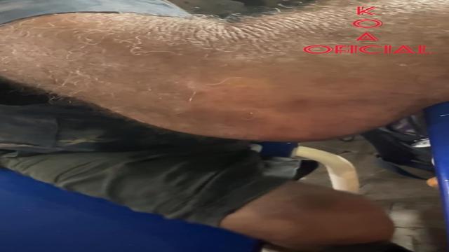Atacando o Vovô morto de bebado 