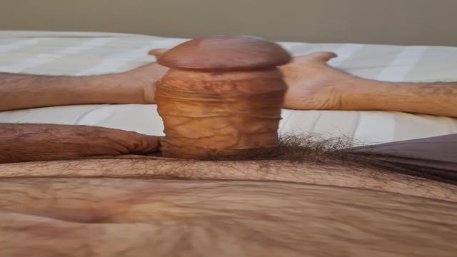 ACORDEI DE PICAO DURAO ARMADO ESFOLADAO NESTA MANHÃ ...