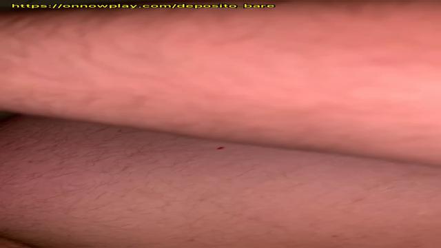 Casado experimentou na pele