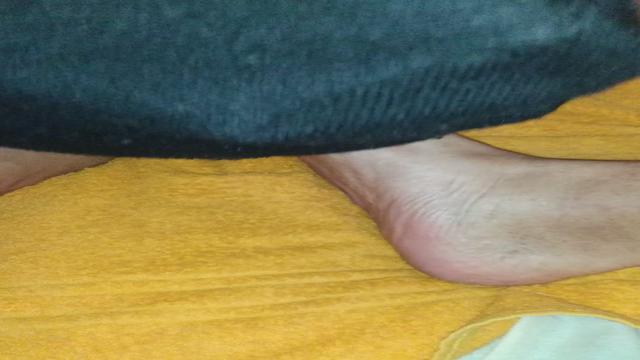 Servindo como necessário 